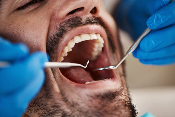 Best Urgent Care for Lost Fillings or Crowns in Fayette, IA