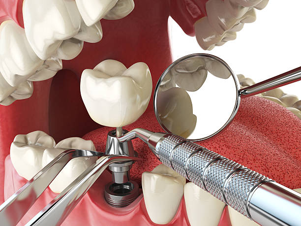 Best Emergency TMJ Treatment in Fayette, IA
