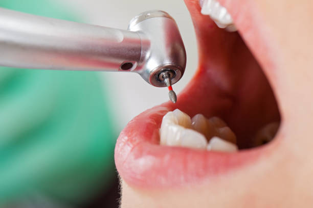 Best Cosmetic Emergency Dentistry in Fayette, IA